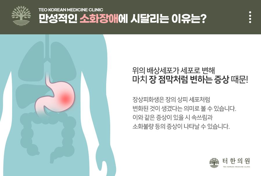 기능성 소화장애를 설명한 위장 그림