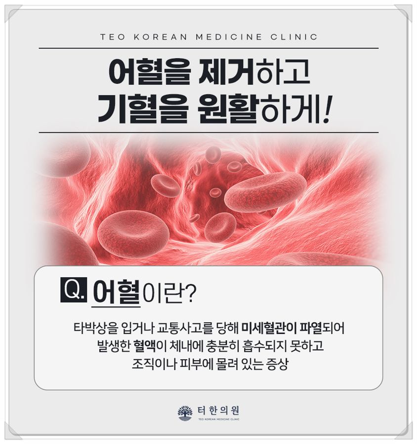 어혈을 설명한 적혈구 안내문