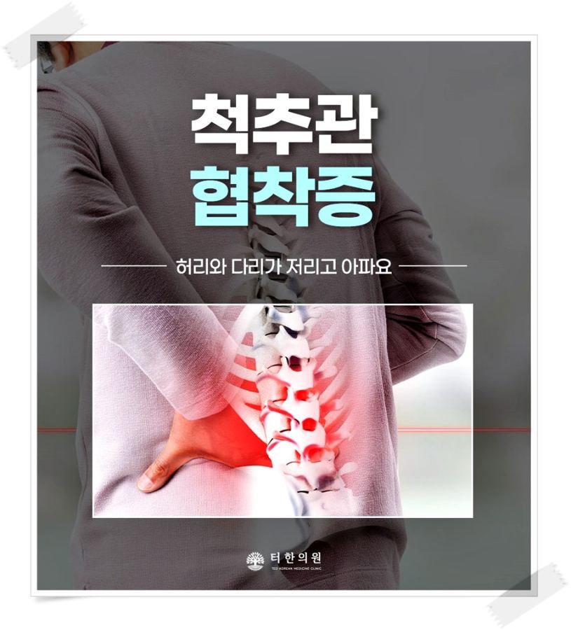 허리 통증을 표시한 협착증 안내문
