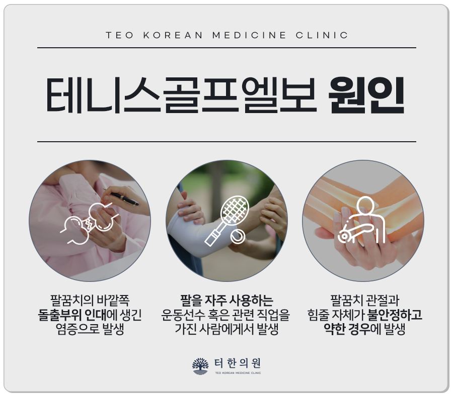 테니스골프엘보 원인을 사진으로 설명한 안내문