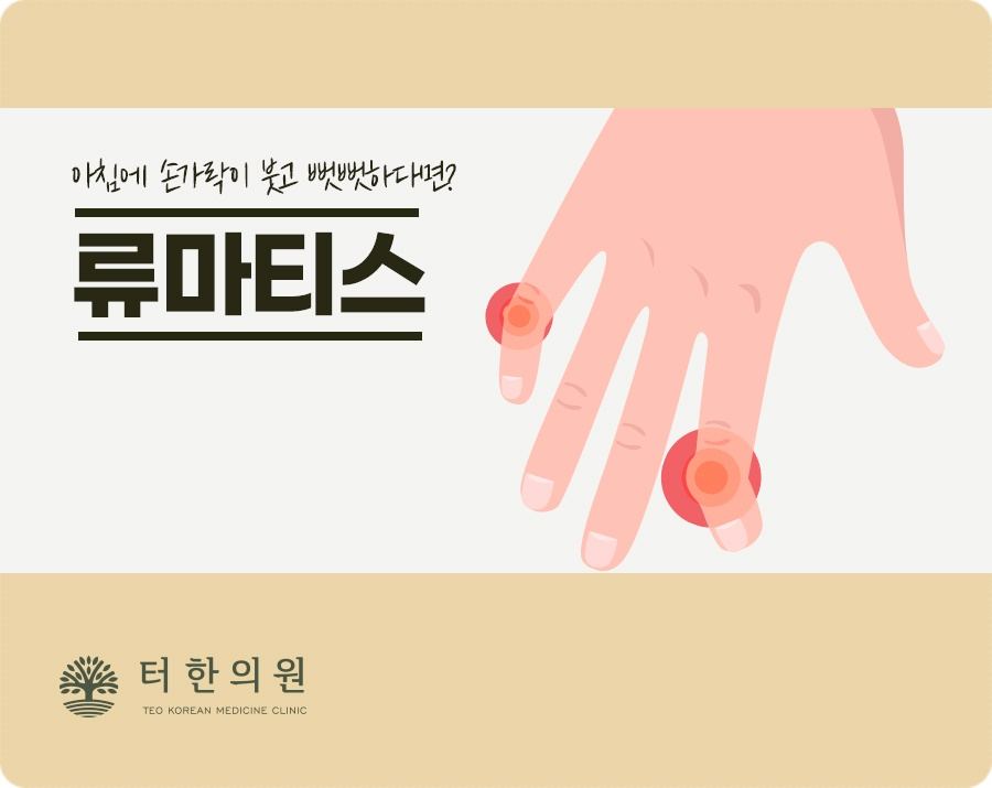 류마티스 증상을 표시한 손 일러스트