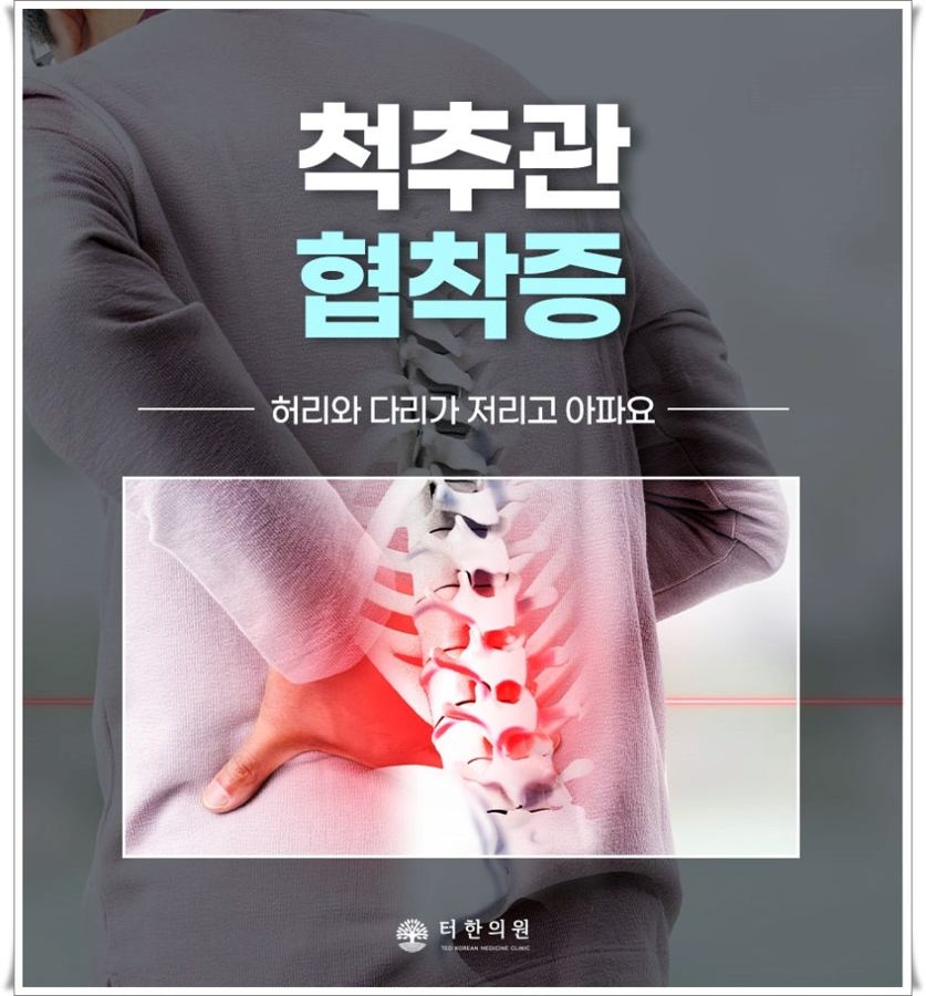 허리 통증을 표시한 협착증 안내문