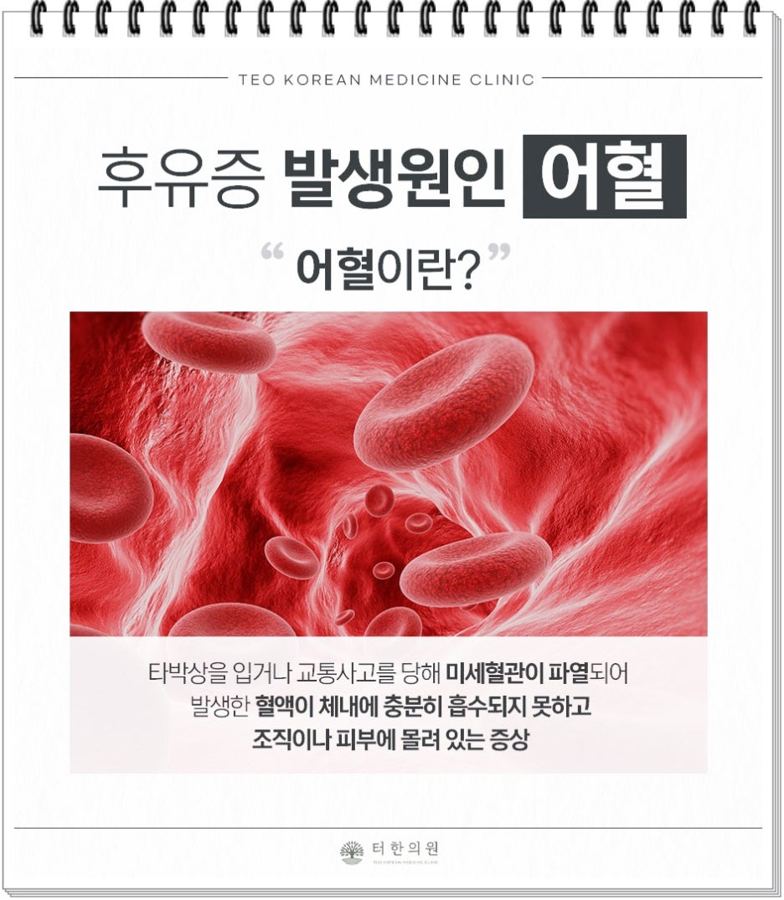 후유증 발생원인 어혈을 설명하는 카드뉴스