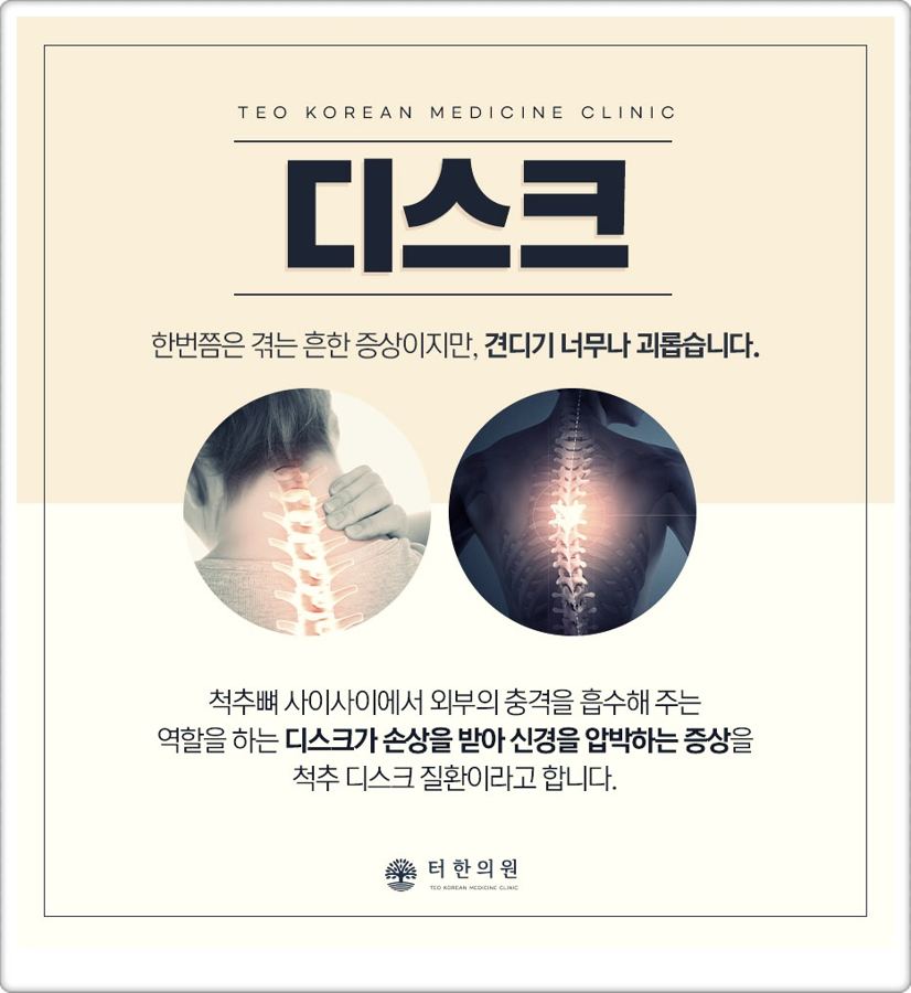 목을 짚은 사람과 척추 해부 이미지로 디스크를 설명한 안내 이미지