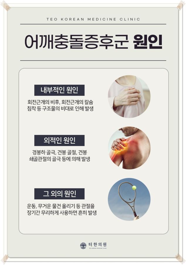 어깨충돌증후군의 원인을 정리한 안내 그림
